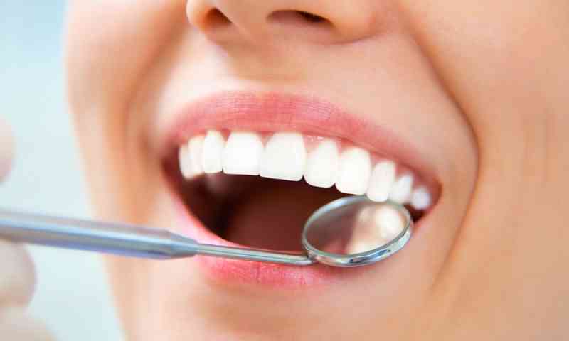 Importancia del mock up dental