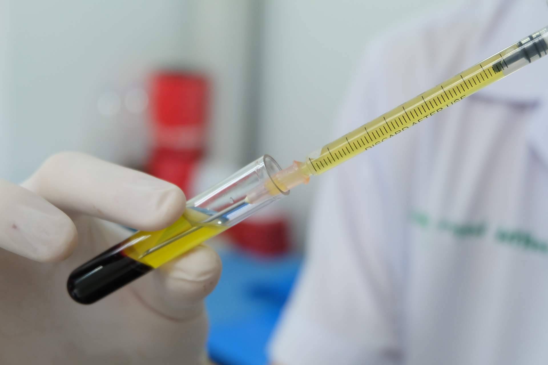 ¿Qué es un tratamiento de plasma rico en plaquetas?: Clínica Estética Alicante Rosa Mora